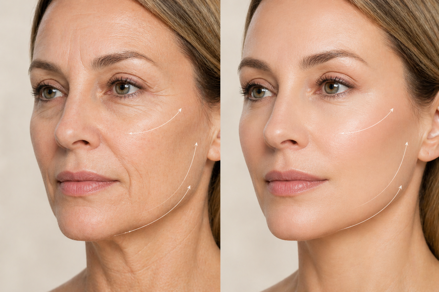 Deep Rejuvenation