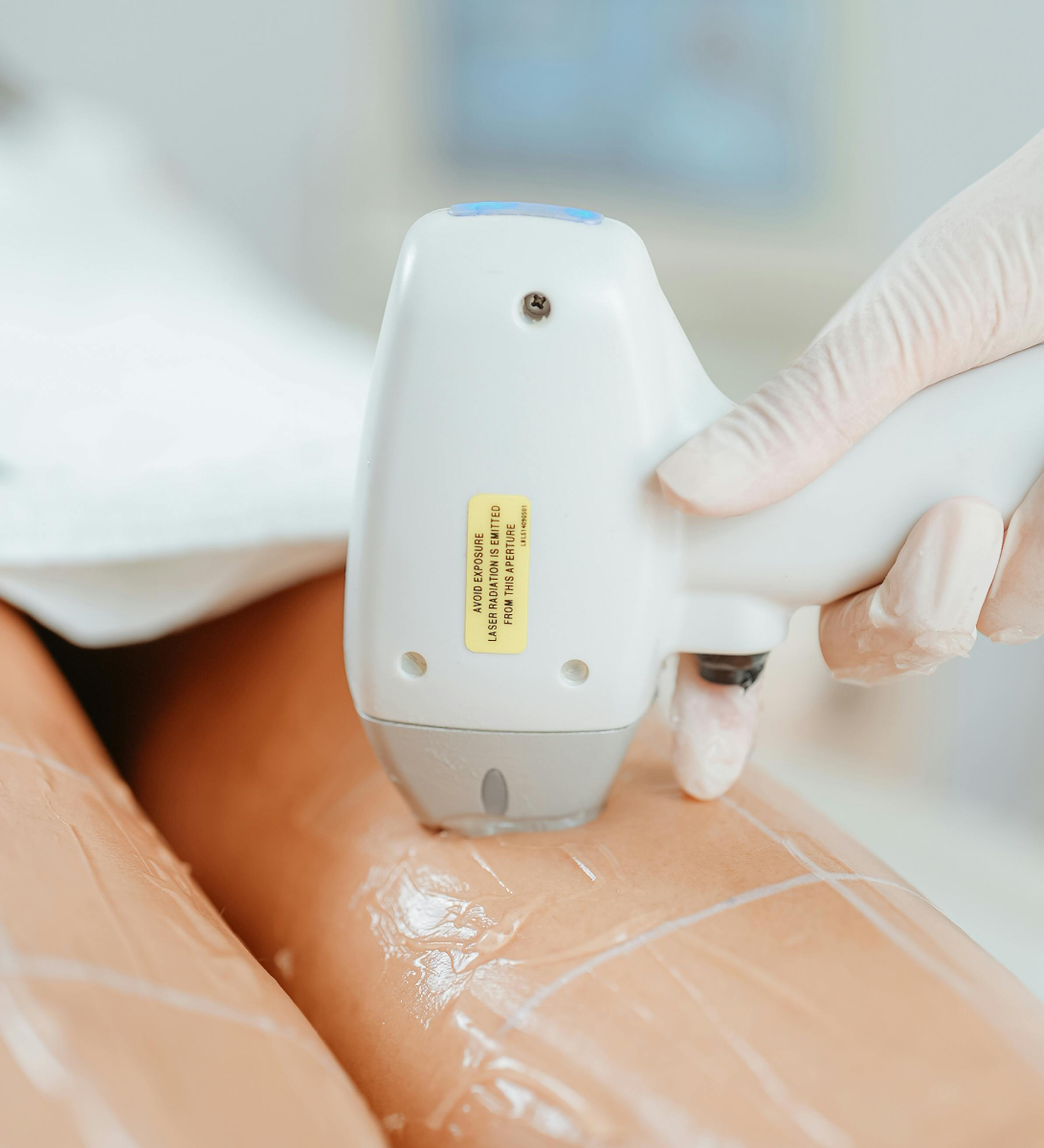 Shockwave for Cellulite Reduction