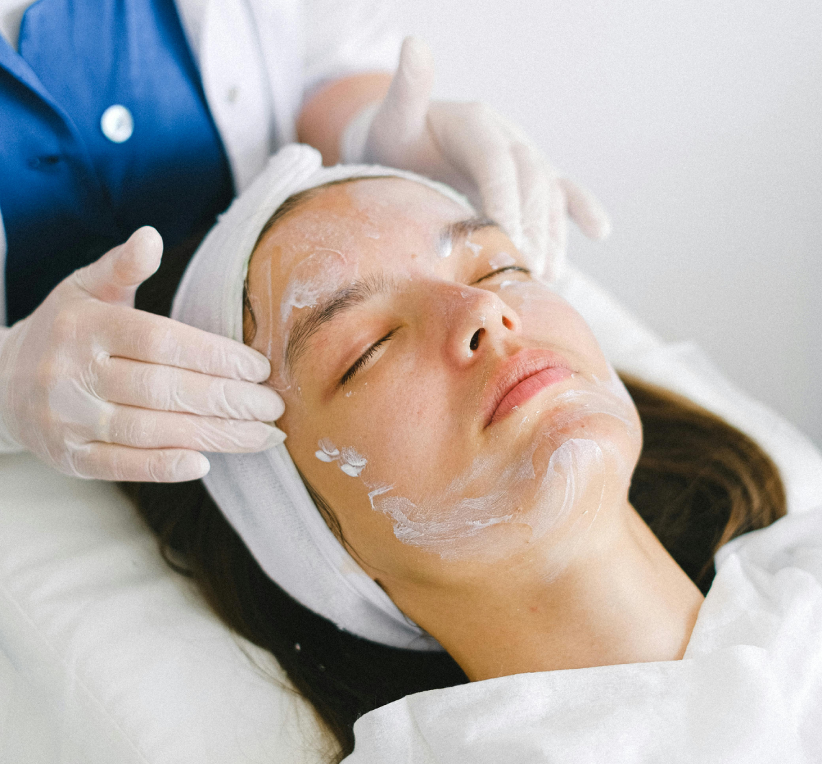Perfect Derma Peel treatment at IUVENTUS Medical Center Las Vegas